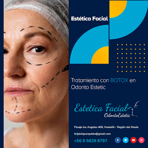 BOTOX HUALAÑÉ ODONTOESTETIC